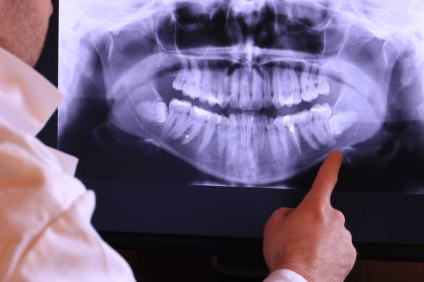 Best Emergency Cosmetic Dentistry (e.g., broken veneers) in Papillion, NE